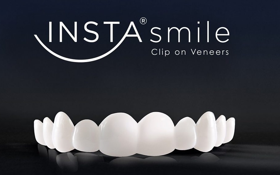 Instasmile UK: Custom At-Home Clip-On Veneers for a Confident, Affordable Perfect Smile