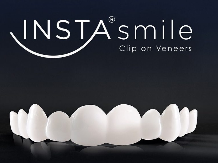 Instasmile Complete Upper & Lower Custom Clip-On Veneer Set